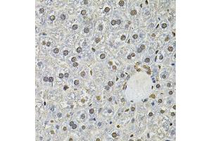 Immunohistochemistry of paraffin-embedded mouse liver using IFI16 Antibody. (IFI16 抗体)