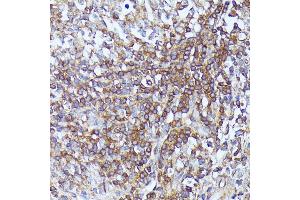 Immunohistochemistry of paraffin-embedded human appendix using Septin 1 antibody (ABIN7270202) at dilution of 1:100 (40x lens). (Septin 1 抗体  (AA 270-370))
