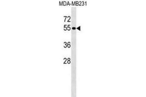 Western Blotting (WB) image for anti-Protein tyrosine Phosphatase, Non-Receptor Type 18 (Brain-Derived) (PTPN18) antibody (ABIN2999086) (PTPN18 抗体)