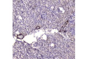 IHC analysis of CKB using anti-CKB antibody . (CKB 抗体  (AA 7-381))