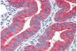 Human Uterus (formalin-fixed, paraffin-embedded) stained with CYCS antibody ABIN462359 followed by biotinylated anti-mouse IgG secondary antibody ABIN481714, alkaline phosphatase-streptavidin and chromogen. (Cytochrome C 抗体)