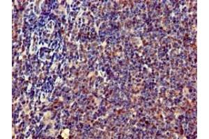 Immunohistochemistry of paraffin-embedded human lymph node tissue using ABIN7169238 at dilution of 1:100 (ERN1 抗体  (AA 493-561))