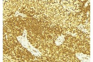 ABIN6267689 at 1/100 staining Mouse spleen tissue by IHC-P. (FANCD2 抗体  (pSer222))