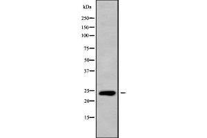 Western blot analysis of CLEC6A using HepG2 whole cell lysates