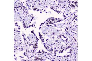 IHC analysis of SMC3 using anti-SMC3 antibody (ABIN5693037).