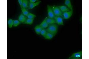 Immunofluorescence staining of Hela cells with ABIN7152176 at 1:50, counter-stained with DAPI. (EIF4G2 抗体  (AA 706-907))
