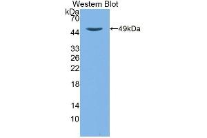 Detection of Recombinant TTPa, Mouse using Polyclonal Antibody to Alpha-Tocopherol Transfer Protein (TTPa) (TTPA 抗体  (AA 88-253))