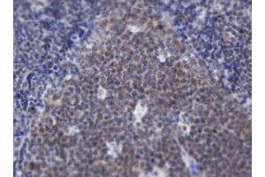 Image no. 1 for anti-Adrenocortical Dysplasia Homolog (ACD) antibody (ABIN1496406) (ACD 抗体)