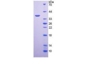 SDS-PAGE analysis of Mouse Arginase Protein. (ARG 蛋白)