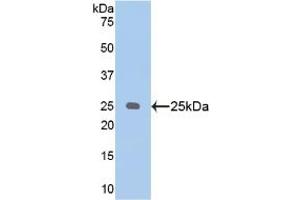 Western blot analysis of recombinant Human PSA. (NPEPPS 抗体  (AA 584-793))