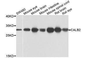 Western blot analysis of extracts of various cell lines, using CALB2 antibody. (Calretinin 抗体)