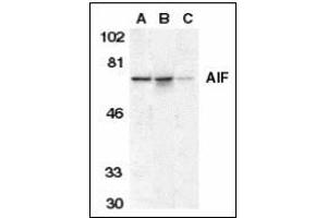 Western blot analysis of AIF in K562 cell lysate (A), mouse (B), and rat (C) liver tissue lysates with AIF antibody at 1 µg/ml. (AIF 抗体  (AA 593-606))