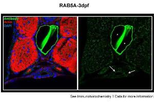 Immunohistochemistry (IHC) image for anti-RAB5A, Member RAS Oncogene Family (RAB5A) (Middle Region) antibody (ABIN2786773)