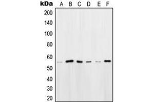Western Blotting (WB) image for anti-POU domain, class 2, transcription factor 2 (POU2F2) (N-Term) antibody (ABIN7296642)