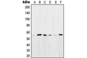 Western blot analysis of OCT2 expression in HeLa (A), HEK293T (B), Ramos (C), K562 (D), Raji (E), NIH3T3 (F) whole cell lysates. (Oct-2 抗体  (N-Term))