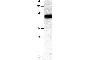 Western blot analysis of Mouse kidney tissue, using TNFRSF11B Polyclonal Antibody at dilution of 1:400 (Osteoprotegerin 抗体)