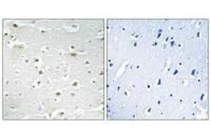 Immunohistochemistry analysis of paraffin-embedded human brain tissue using DDX3Y antibody. (DDX3Y 抗体)
