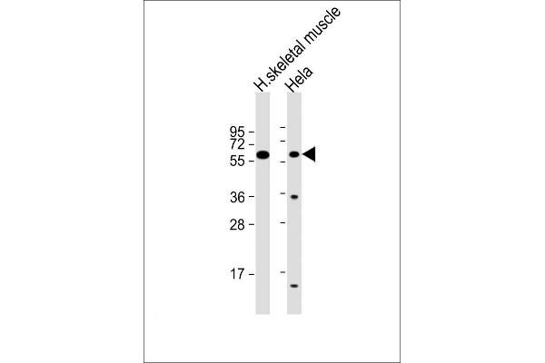SLC29A2 anticorps  (AA 1-31)