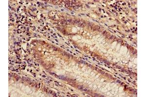 Immunohistochemistry of paraffin-embedded human colon tissue using ABIN7143509 at dilution of 1:100 (ARL4D 抗体  (AA 2-201))