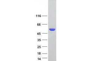 Aldehyde Dehydrogenase 3 Family, Member A1 (ALDH3A1) (Transcript Variant 3) protein (Myc-DYKDDDDK Tag)