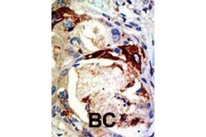 Immunohistochemistry (Paraffin-embedded Sections) (IHC (p)) image for anti-V-Myb Myeloblastosis Viral Oncogene Homolog (Avian) (MYB) (AA 506-534), (Sumoylation Site) antibody (ABIN389068)