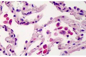 Human Lung: Formalin-Fixed, Paraffin-Embedded (FFPE) (TMEM123 抗体  (AA 173-188))