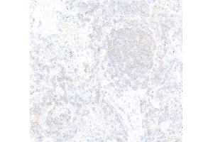 Immunohistochemistry (IHC) image for anti-CD22 Molecule (CD22) (AA 750-800) antibody (ABIN7795736) (Recombinant CD22 抗体  (AA 750-800))