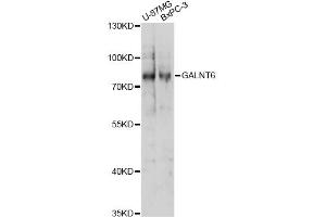 Western blot analysis of extracts of various cell lines, using GALNT6 antibody (ABIN6294086) at 1:1000 dilution. (GALNT6 抗体)