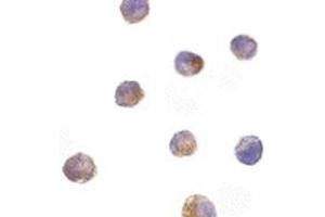 Immunocytochemistry of DFF40 in K562 cells with AP30288PU-N DFF40 antibody at 10 μg/ml.