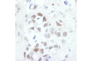 Immunohistochemistry (IHC) image for anti-Jun Proto-Oncogene (JUN) (AA 1-40) antibody (ABIN7453667)
