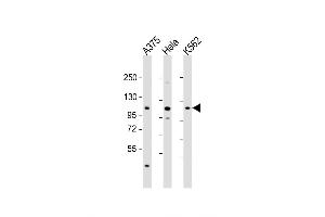 Western Blot at 1:2000 dilution Lane 1: A375 whole cell lysate Lane 2: Hela whole cell lysate Lane 3: K562 whole cell lysate Lysates/proteins at 20 ug per lane. (IDE 抗体  (AA 406-435))