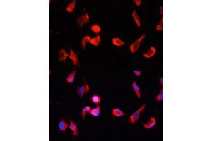 Immunofluorescence analysis of HeLa cells using CG Polyclonal Antibody (ABIN1678951, ABIN3017618, ABIN3017619 and ABIN6220165) at dilution of 1:100 (40x lens). (CAMKII gamma 抗体  (AA 300-410))