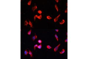 Immunofluorescence (IF) image for anti-Calcium/calmodulin-Dependent Protein Kinase II gamma (CAMK2G) (AA 300-410) antibody (ABIN1678951)