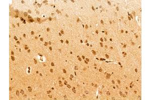 ABIN7094774 and ABIN7098825 at 1/100 staining Rat brain tissue by IHC-P.