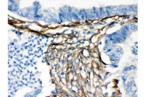 Caldesmon was detected in paraffin-embedded sections of human intestinal tissues using rabbit anti- Caldesmon Antigen Affinity purified polyclonal antibody (Catalog # ) at 1 ? (Caldesmon 抗体  (AA 1-120))