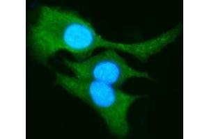 IF analysis of AKR1B10 using anti-AKR1B10 antibody (ABIN5518800).