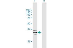 Western Blot analysis of RARRES1 expression in transfected 293T cell line by RARRES1 MaxPab polyclonal antibody. (RARRES1 抗体  (AA 1-294))