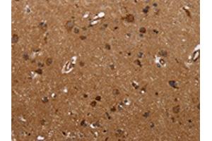 The image on the left is immunohistochemistry of paraffin-embedded Human brain tissue using ABIN7190664(FMN2 Antibody) at dilution 1/30, on the right is treated with synthetic peptide. (Formin 2 抗体)