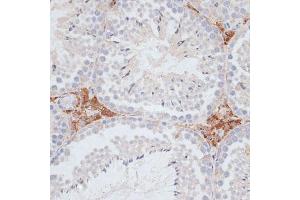 Immunohistochemistry of paraffin-embedded mouse testis using KIFC1 antibody (ABIN1680592, ABIN3017666, ABIN3017667 and ABIN6220203) at dilution of 1:100 (40x lens). (KIFC1 抗体  (AA 1-250))