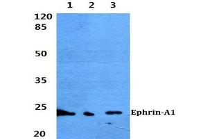 Western blot (WB) analyzes of Ephrin-A1 antibody at 1/500 dilution. (Ephrin A1 抗体)