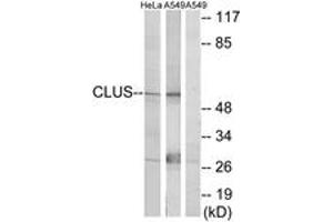 Western blot analysis of extracts from HeLa cells/A549 cells, using CLUS Antibody. (Clusterin 抗体  (AA 400-449))