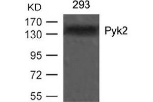 Image no. 3 for anti-PTK2B Protein tyrosine Kinase 2 beta (PTK2B) (Tyr402) antibody (ABIN197440) (PTK2B 抗体  (Tyr402))
