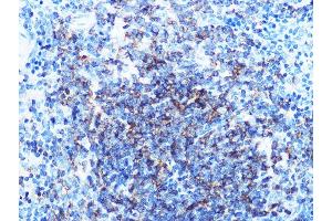 Immunohistochemistry of paraffin-embedded mouse spleen using CD79B Rabbit mAb (ABIN1682474, ABIN3018855, ABIN3018856 and ABIN7101674) at dilution of 1:100 (40x lens).