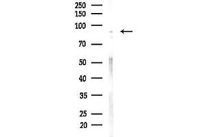 Western blot analysis of lysates from Hela cells(heat-shock,45 min treatment), using PHF17 Antibody at 1/1000 dilution.