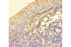 Immunohistochemistry of paraffin-embedded human tonsil tissue using ABIN7156438 at dilution of 1:100 (ITGA4 抗体  (AA 376-558))