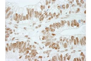 Immunohistochemistry (IHC) image for anti-Retinoblastoma Binding Protein 5 (RBBP5) (C-Term) antibody (ABIN7448757) (RBBP5 抗体  (C-Term))