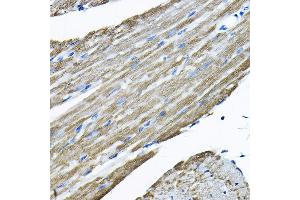 Immunohistochemistry of paraffin-embedded mouse heart using UBE2F Rabbit pAb  at dilution of 1:200 (40x lens). (UBE2F 抗体  (AA 1-185))
