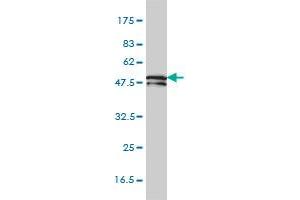 Western Blotting (WB) image for anti-Keratin 81 (KRT81) (AA 1-202) antibody (ABIN561636)