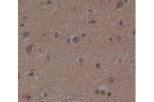 Immunohistochemistry (IHC) image for anti-Proteasome (Prosome, Macropain) 26S Subunit, Non-ATPase, 4 (Psmd4) (AA 1-377) antibody (ABIN5014171)