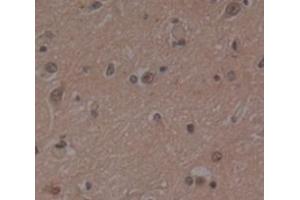 Used in DAB staining on fromalin fixed paraffin- embedded Kidney tissue (PSMD4/ASF 抗体  (AA 1-377))